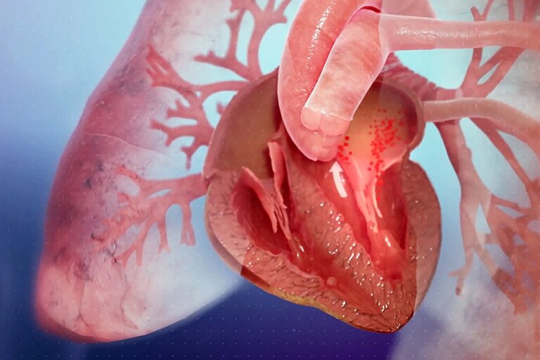1800x1200 medical animation inside looks at heart failure video